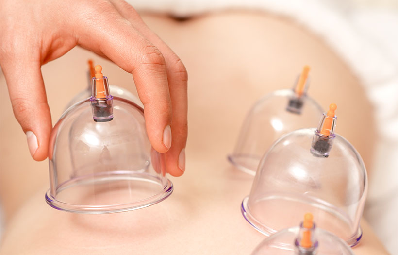 A cupping massage